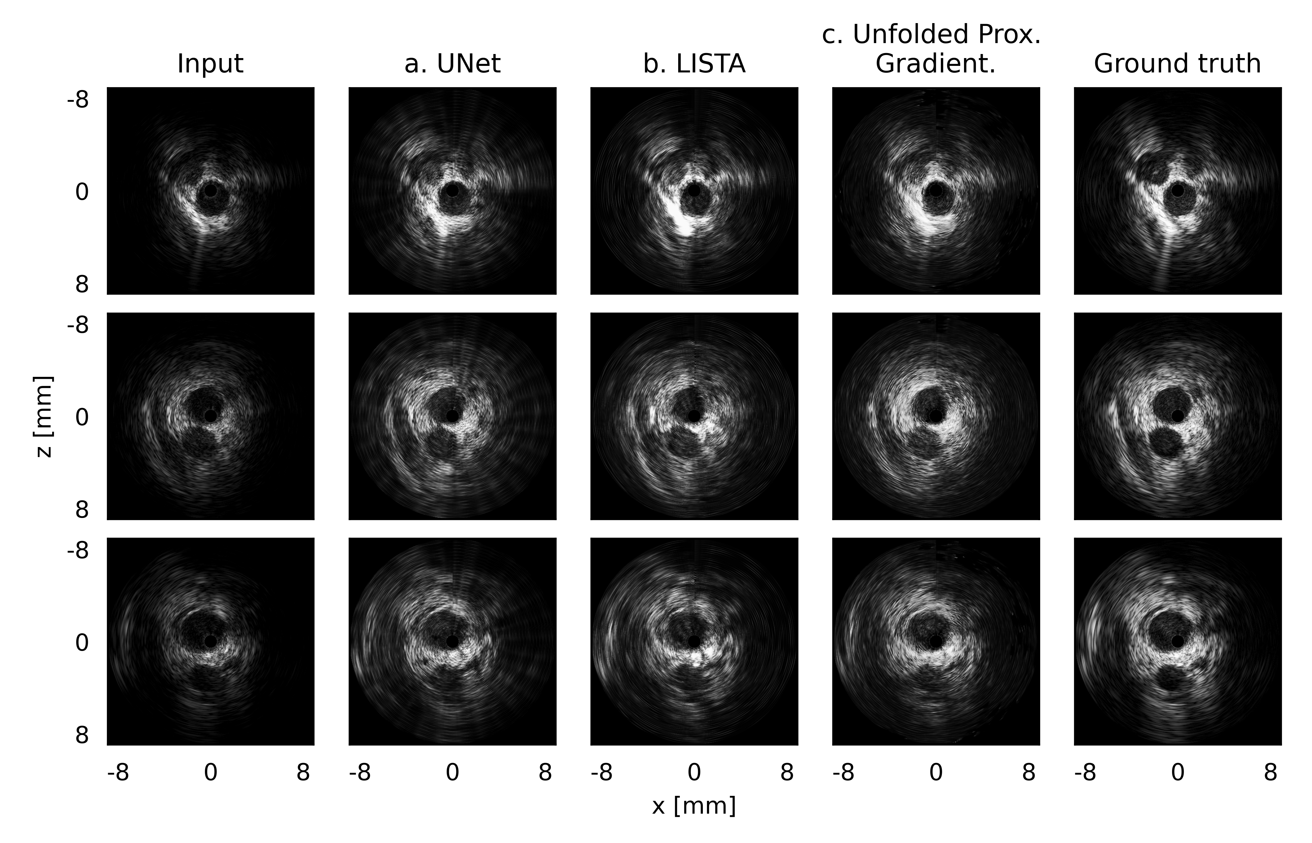 IVUS recon