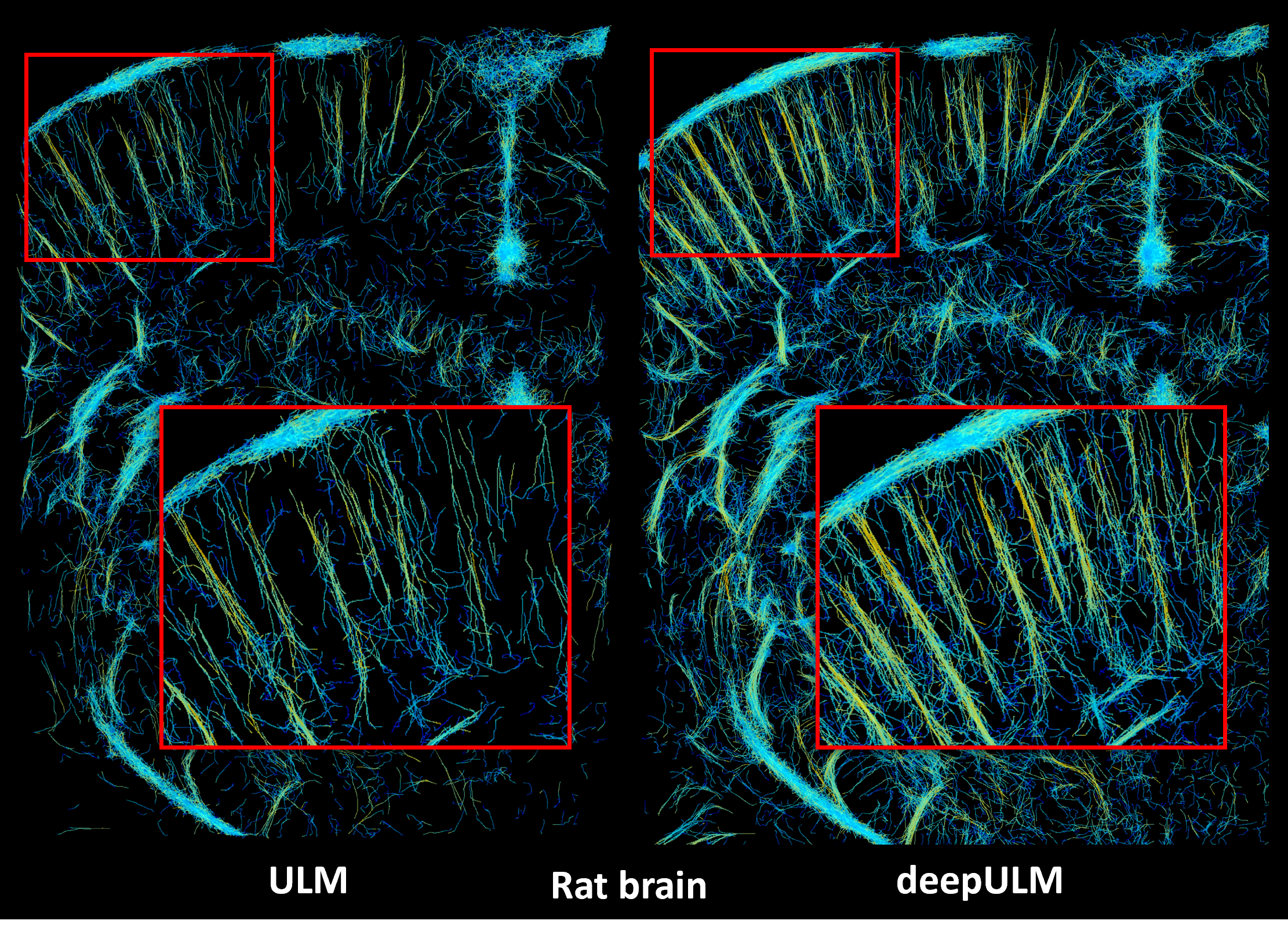 ratbrain