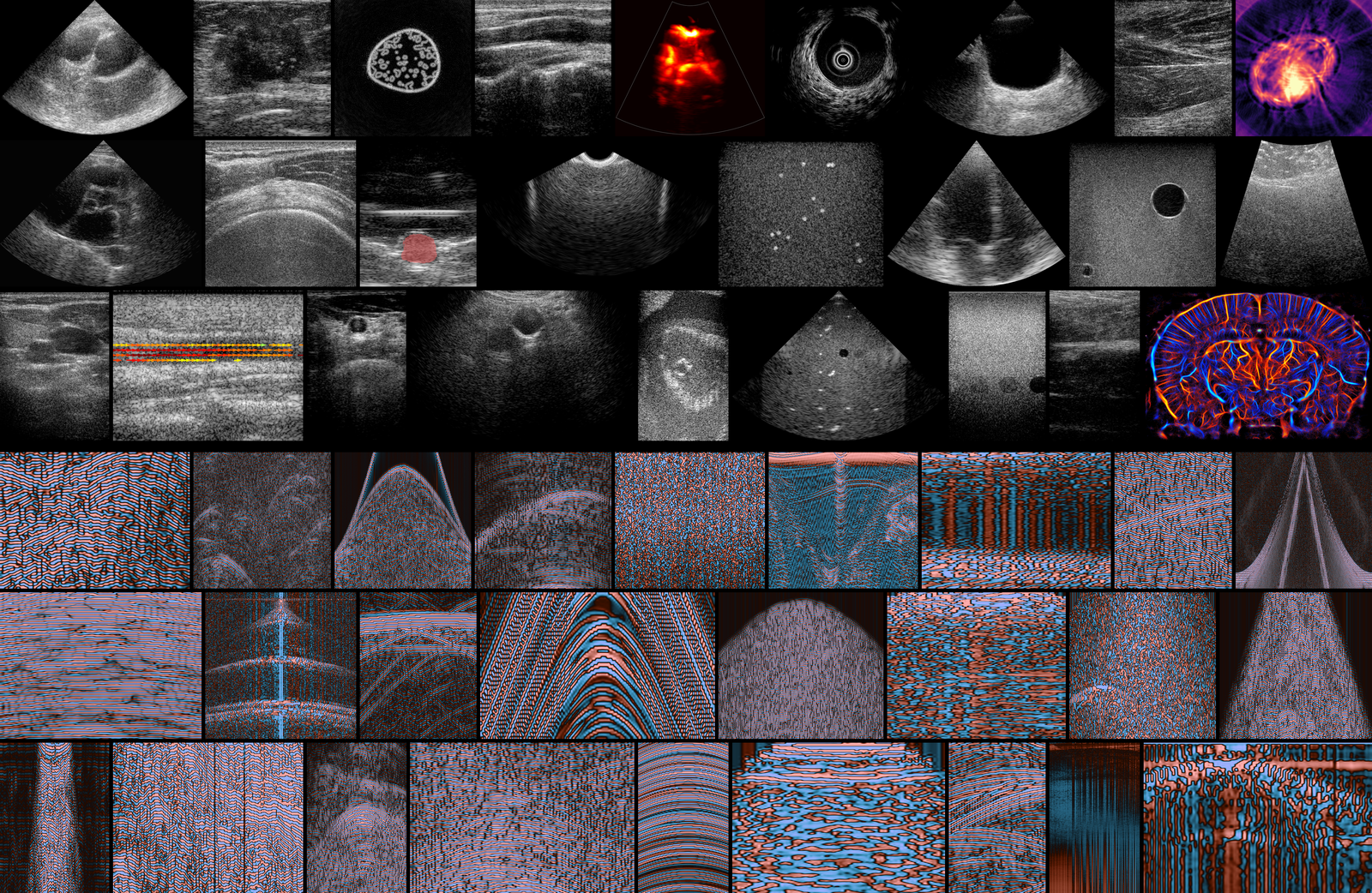 Samples from the Open-H-RF dataset: reconstructed images (top) and corresponding raw channel data (bottom)